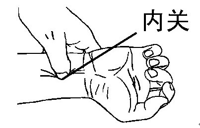 降五火按五穴 降心火-按内关穴