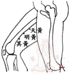 三黄穴位置图：天黄 明黄 其黄-眼睛疾病穴位疗法